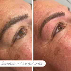 Avant/après épilation sourcils