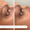 Rehaussement et teinture des cils
