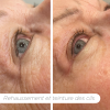 Rehaussement et teinture des cils