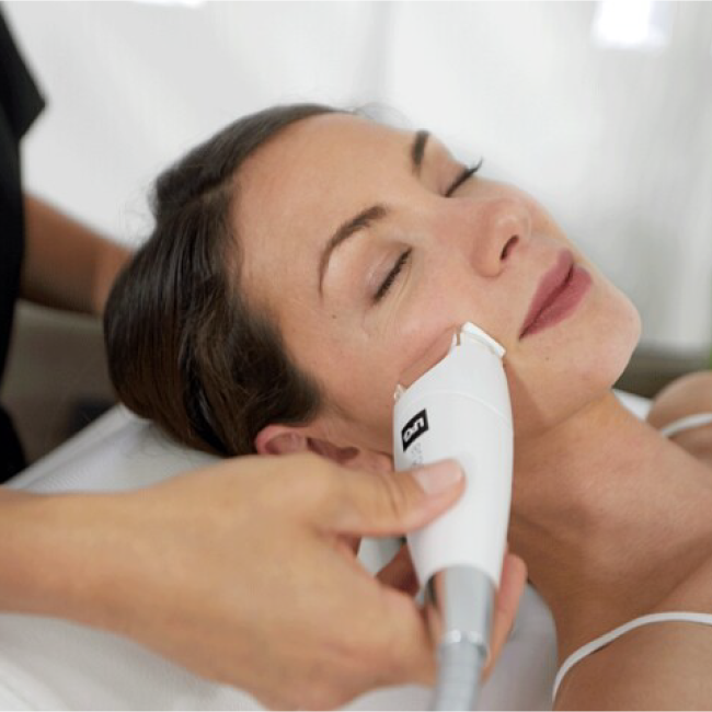 Soin visage LPG Endermologie